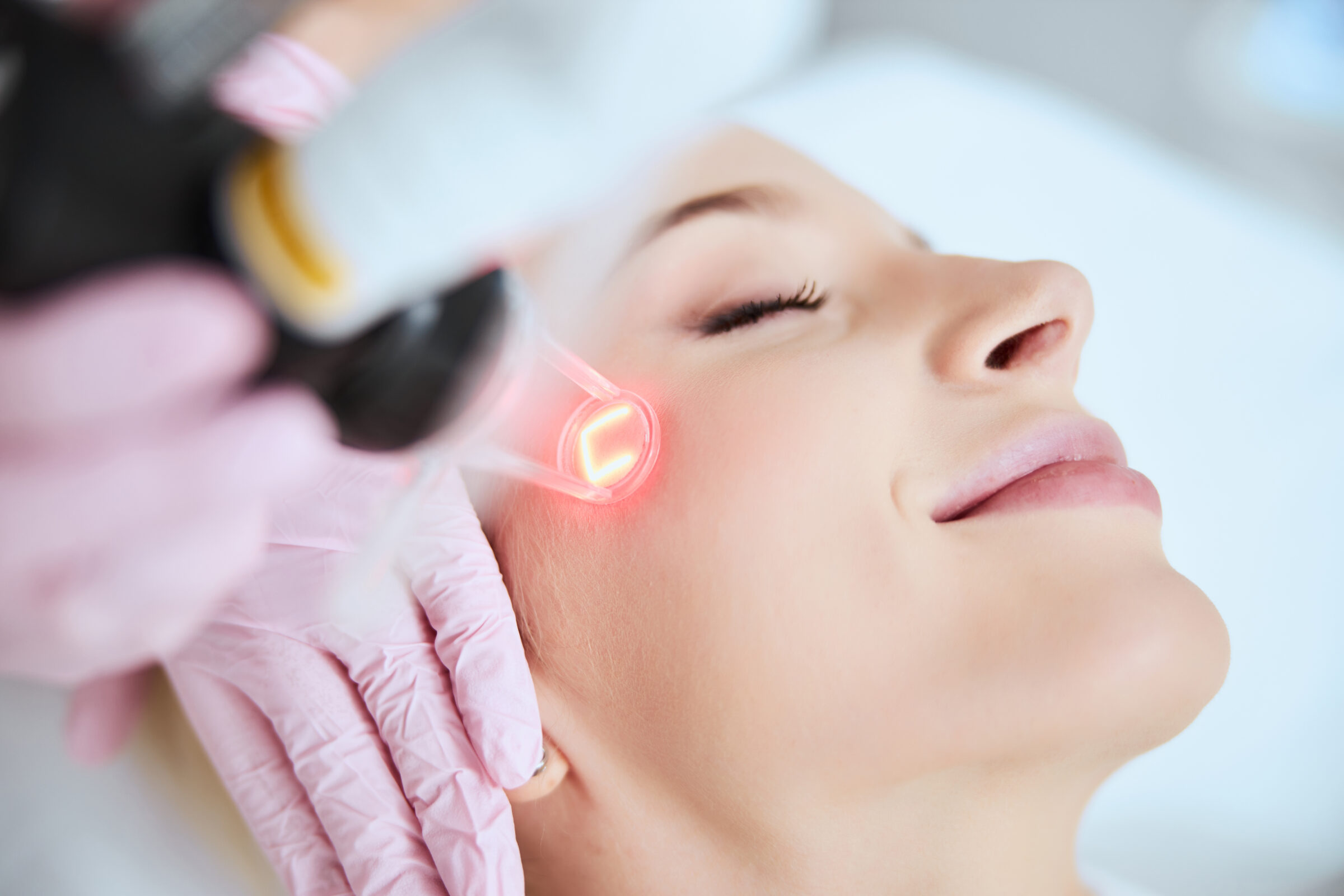 A woman getting laser skin resurfacing treatment